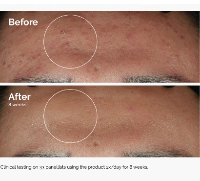 Niacinamide 10% + Zinc 1% - Siero Viso Anti-Imperfezioni 30 ml