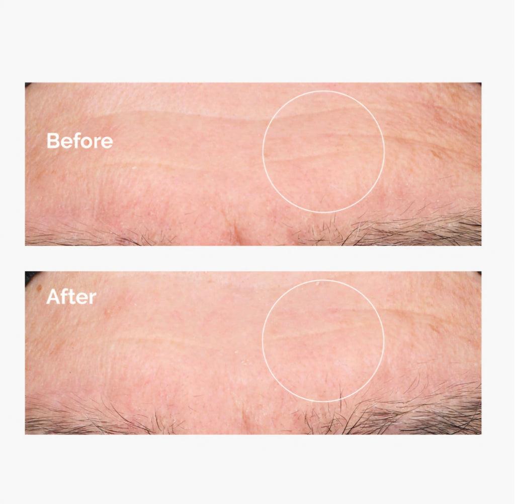The Ordinary Acido Ialuronico 2% + B5 - Siero Idratante 30 ml