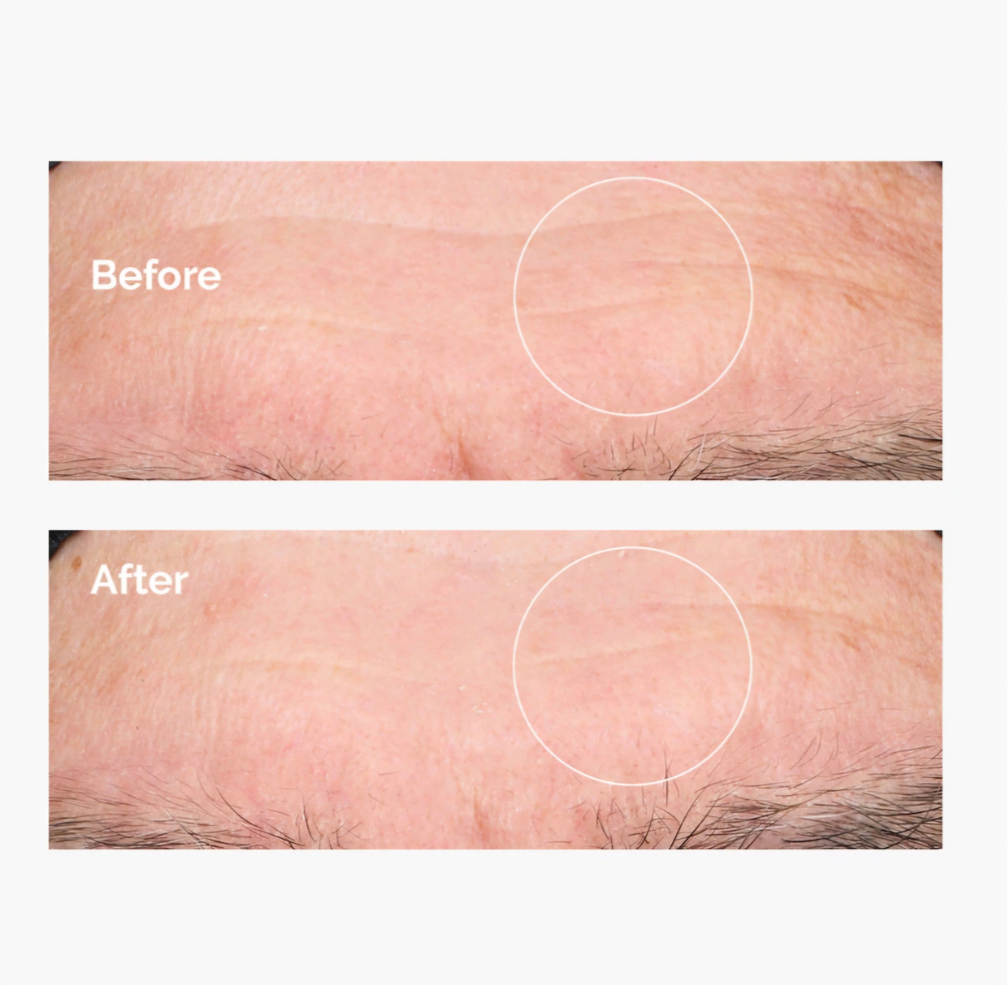 The Ordinary Acido Ialuronico 2% + B5 - Siero Idratante 30 ml